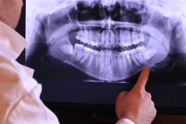 Best Emergency Treatment for Dental Infections or Abscesses in Madisonville, TN